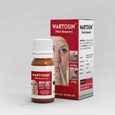 Wartosin Wart Remover